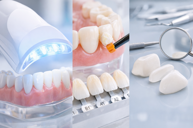 Stomatologia estetyczna w Łodzi – wybielanie, bonding, licówki. Co wybrać i ile to kosztuje?