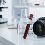 Lipoproteina(a) – co oznacza wynik i dlaczego warto znać go choć raz?